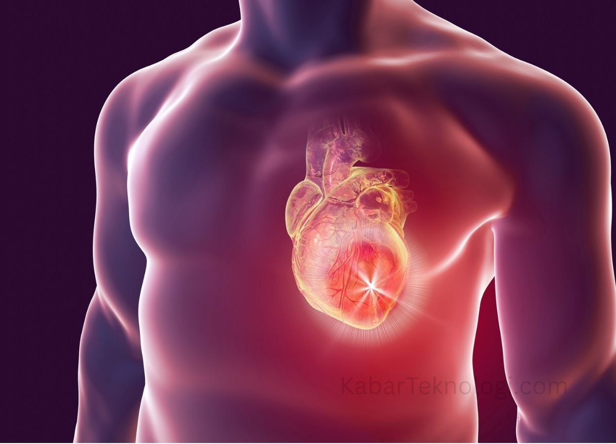 Teknologi Arteri di Atas Chip Bantu Prediksi Risiko Stroke Lebih Akurat - KabarTeknologi.com